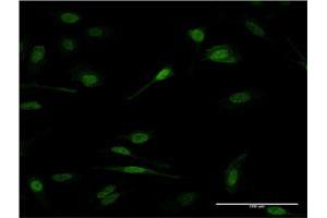 Immunofluorescence of monoclonal antibody to PRDM1 on HeLa cell.