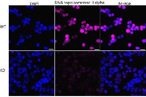 Immunocytochemical staining of HeLa cells using DNA topoisomerase II alpha antibody (ABIN7800574), 1:1,000), Top panel: wild-type (WT), Bottom panal: DNA topoisomerase II alpha shRNA knockdown (KD). (Recombinant Topoisomerase II alpha anticorps)