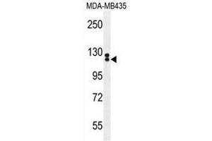 TTLL13 Antibody (Center) western blot analysis in MDA-MB435 cell line lysates (35 µg/lane). (TTLL13 anticorps  (Middle Region))