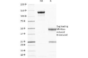 SDS-PAGE Analysis Purified CD44 Mouse Monoclonal Antibody (156-3C11).