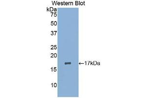 Western blot analysis of the recombinant protein. (LIFR anticorps  (AA 45-184))