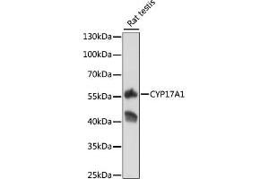 Western blot analysis of extracts of rat testis, using CYP17 antibody (373) at 1:500 dilution. (CYP17A1 anticorps  (AA 209-508))