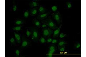 Immunofluorescence of monoclonal antibody to HIPK1 on HeLa cell. (HIPK1 anticorps  (AA 330-430))