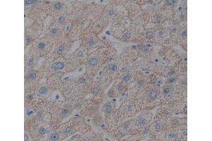 IHC-P analysis of liver tissue, with DAB staining. (HFE2 anticorps  (AA 36-200))