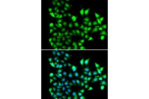Immunofluorescence analysis of MCF7 cell using SNRPD2 antibody. (SNRPD2 anticorps)