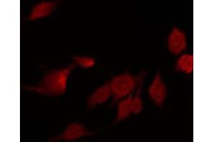 ABIN6268640 staining MCF7 by IF/ICC.