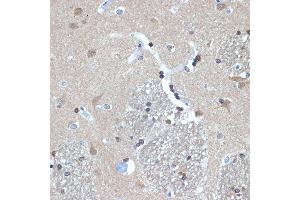 Immunohistochemistry of paraffin-embedded human brain using RanBP9 Rabbit mAb (ABIN7267862) at dilution of 1:100 (40x lens).