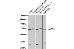 Western blot analysis of extracts of various cell lines, using RAPSN Antibody (ABIN6132583, ABIN6146690, ABIN6146691 and ABIN6222434) at 1:1000 dilution.