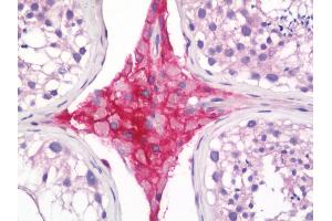 Human Testis: Formalin-Fixed, Paraffin-Embedded (FFPE)