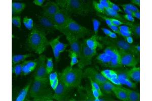 Immunofluorescence staining of SK-N-SH cells (Human neuroblastoma, ATCC HTB-11) (Second Panel). (CAMK2A anticorps  (AA 448-460))