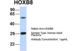 Host: Rabbit Target Name: HOXB8 Sample Type: Human Adult Placenta Antibody Dilution: 1. (HOXB8 anticorps  (N-Term))