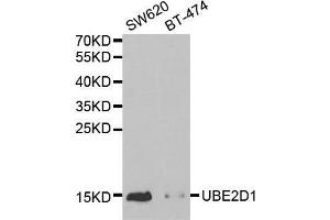 Western blot analysis of extracts of various cell lines, using UBE2D1 antibody. (UBE2D1 anticorps  (AA 1-147))