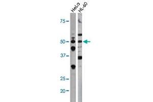 The CDC25A (phospho S75) polyclonal antibody  is used in Western blot to detect Phospho-CDC25A-S75 in Hela (left) and HL-60 (right) cell lysates. (CDC25A anticorps  (pSer76))