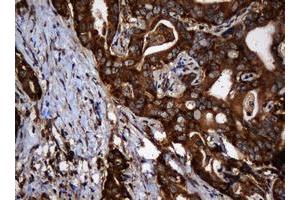 Image no. 6 for anti-SERPINE1 mRNA Binding Protein 1 (SERBP1) (AA 1-262) antibody (ABIN1490674)