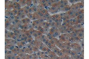 DAB staining on IHC-P; Samples: Human Liver Tissue (Laminin alpha 1 anticorps  (AA 2613-2746))