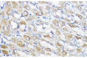 Immunohistochemistry of paraffin-embedded Rat stomach using GPX2 Polyclonal Antibody at dilution of 1:100 (40x lens).