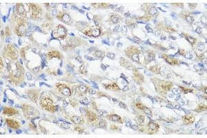 Immunohistochemistry of paraffin-embedded Rat stomach using GPX2 Polyclonal Antibody at dilution of 1:100 (40x lens). (Glutathione Peroxidase 2 anticorps)
