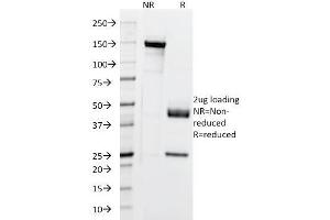 SDS-PAGE Analysis Purified Cytokeratin, 5/6/18 Mouse Monoclonal Antibody (LP34). (Keratin 5,6,18 anticorps)