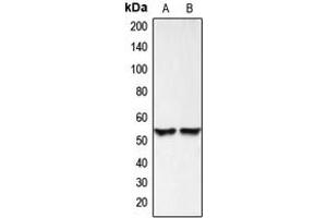 Western blot analysis of BMP3 expression in HEK293T (A), HeLa (B) whole cell lysates. (BMP3 anticorps  (Center))