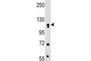 Western blot analysis of MUSK antibody and mouse kidney tissue lysate.