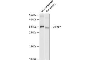 Western blot analysis of extracts of various cell lines, using IGFBP7 antibody (ABIN6131959, ABIN6142263, ABIN6142264 and ABIN6216854) at 1:1000 dilution. (IGFBP7 anticorps  (AA 27-282))