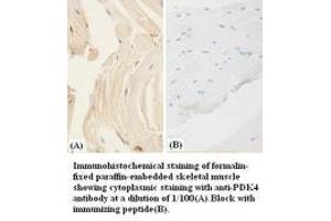 Image no. 1 for anti-Pyruvate Dehydrogenase Kinase, Isozyme 4 (PDK4) antibody (ABIN791131) (PDK4 anticorps)