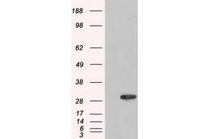 HEK293T cells were transfected with the pCMV6-ENTRY control (Left lane) or pCMV6-ENTRY AK1 (Right lane) cDNA for 48 hrs and lysed. (Adenylate Kinase 1 anticorps)