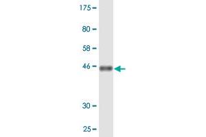 Western Blot detection against Immunogen (46. (PMVK anticorps  (AA 1-192))