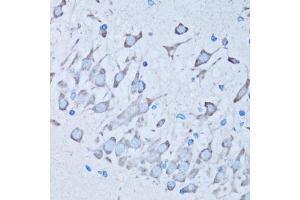 Immunohistochemistry of paraffin-embedded mouse brain using NNMT antibody (ABIN5974021) at dilution of 1/100 (40x lens). (NNMT anticorps)