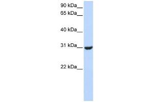 RNF182 antibody used at 1 ug/ml to detect target protein. (RNF182 anticorps  (Middle Region))