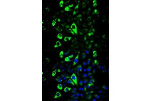 Immunofluorescence analysis of U2OS cells using GZMB antibody (ABIN5971382). (GZMB anticorps)