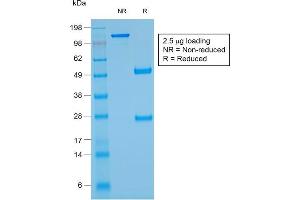 SDS-PAGE Analysis Purified Glycophorin A Mouse Recombinant Monoclonal Ab (rGYPA/280). (Recombinant CD235a/GYPA anticorps)