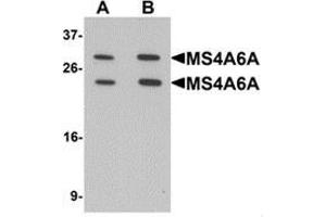 Western blot analysis of MS4A6A in 293 cell lysate with MS4A6A Antibody  at (A) 1 and (B) 2 ug/mL. (MS4A6A anticorps  (N-Term))