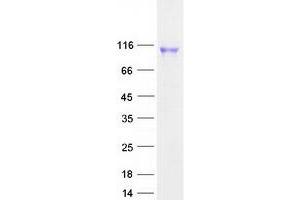 Validation with Western Blot