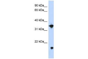 GPD1 antibody used at 1 ug/ml to detect target protein. (GPD1 anticorps)