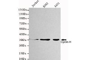Western blot detection of Cyclin H in Jurkat,K562 and A431 cell lysates using Cyclin H mouse mAb (1:1000 diluted). (Cyclin H anticorps)