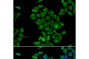 Immunofluorescence analysis of HeLa cells using CTNS Polyclonal Antibody (CTNS anticorps)
