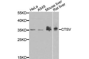 Western blot analysis of extracts of various cell lines, using CTSV antibody. (Cathepsin L2 anticorps  (AA 105-334))