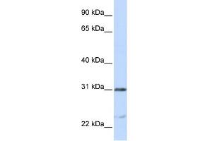WB Suggested Anti-NUSAP1 Antibody Titration:  0. (NUSAP1 anticorps  (C-Term))