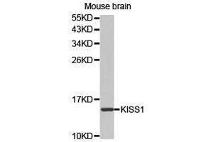 Western Blotting (WB) image for anti-KiSS-1 Metastasis-Suppressor (KISS1) antibody (ABIN1873419) (KISS1 anticorps)