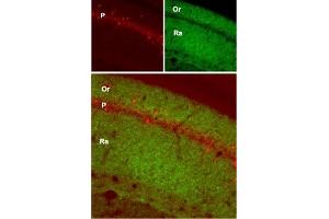 Expression of GluR1 in mouse hippocampus - Immunohistochemical staining of mouse hippocampus with Anti-GluR1 (GluA1) (extracellular) Antibody (ABIN7043226, ABIN7044328 and ABIN7044329).