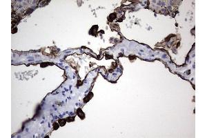 Immunohistochemistry (IHC) image for anti-Keratin Acidic (AE1) antibody (ABIN2715666)