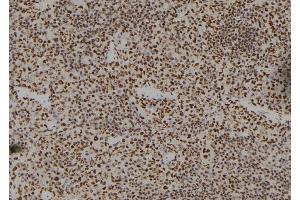 ABIN6279487 at 1/100 staining Mouse spleen tissue by IHC-P. (Homeobox A11 anticorps)