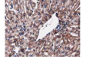 Image no. 5 for anti-Sequestosome 1 (SQSTM1) antibody (ABIN1499989)