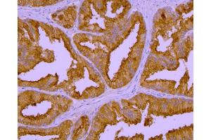 Immunohistochemistry of GCPII in human prostate by monoclonal antibody.