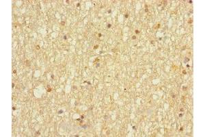 Immunohistochemistry of paraffin-embedded human brain tissue using ABIN7149614 at dilution of 1:100 (DHRS13 anticorps  (AA 1-327))
