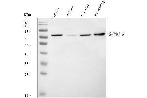 Western blot analysis of Smpd1 using anti-Smpd1 antibody (ABIN7600575).