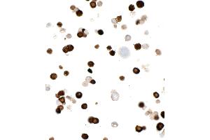 Immunocytochemistry (ICC) image for anti-Myc Tag (AA 410-419) antibody (ABIN7453372) (Recombinant Myc Tag anticorps  (AA 410-419))