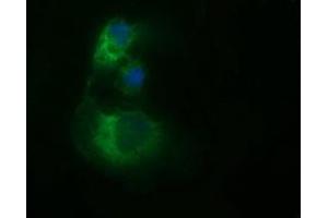 Image no. 3 for anti-Tubulin, beta 2B (TUBB2B) antibody (ABIN1501571)