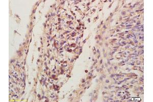 Formalin-fixed and paraffin embedded rat brain labeled with Anti--LIS1 Polyclonal Antibody, Unconjugated (ABIN676868) at 1:200, followed by conjugation to the secondary antibody and DAB staining